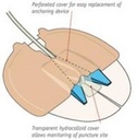 DRAIN GUARD - ANCHORING DEVICE FOR PERCUTANEOUS CATHETERS - 25 (8150)