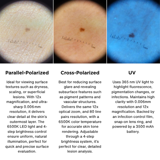 Illuco IDS 9100 Dematoscope 12x Optical Magnification