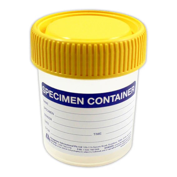 STERILE SPECIMEN JAR 70ML LABELLED YELLOW CAP 7593 - Pack of 10