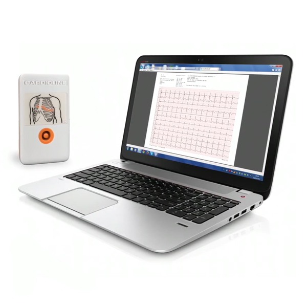 CARDIOLINE TOUCH PC ECG WIRELESS WITH GLASGOW INTERPRETATION