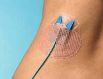 DRAIN GUARD - ANCHORING DEVICE FOR PERCUTANEOUS CATHETERS - Box of 25 (8150)